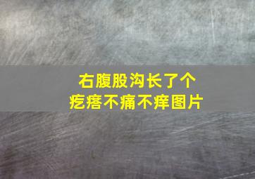 右腹股沟长了个疙瘩不痛不痒图片