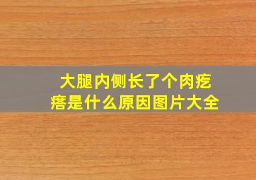 大腿内侧长了个肉疙瘩是什么原因图片大全