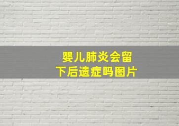 婴儿肺炎会留下后遗症吗图片