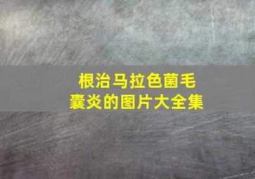 根治马拉色菌毛囊炎的图片大全集