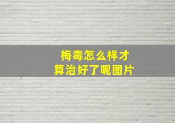 梅毒怎么样才算治好了呢图片