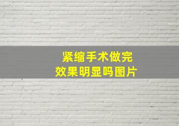 紧缩手术做完效果明显吗图片