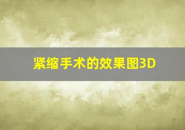 紧缩手术的效果图3D