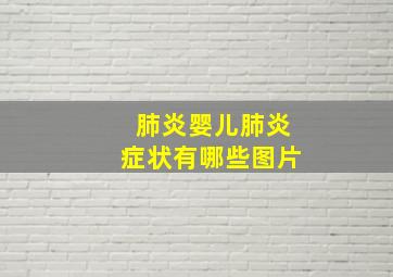 肺炎婴儿肺炎症状有哪些图片