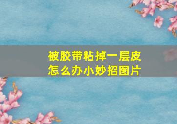 被胶带粘掉一层皮怎么办小妙招图片